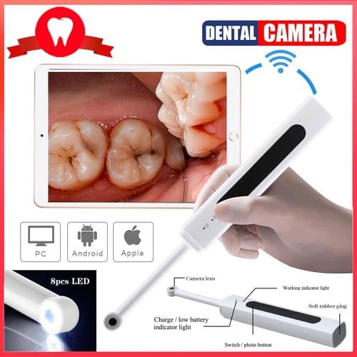 Wireless Cordless Dental Intraoral Camera HD 1080p WIFI Endoscope Teeth Mirror - image 1