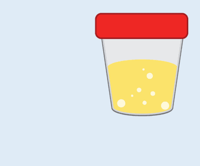 ETG Alcohol Test, Urine - image 1