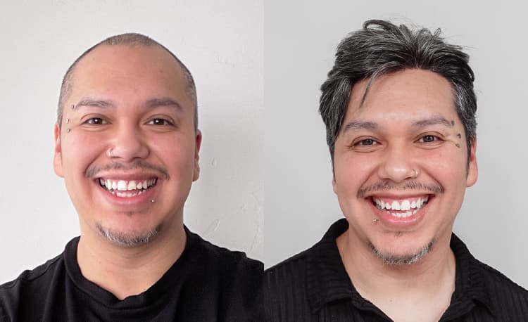Lordhair Men's Hair Systems - image 1